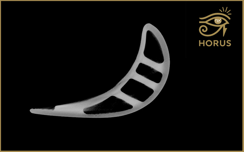 Horus - module reconstruction avancée pour tomographie CT