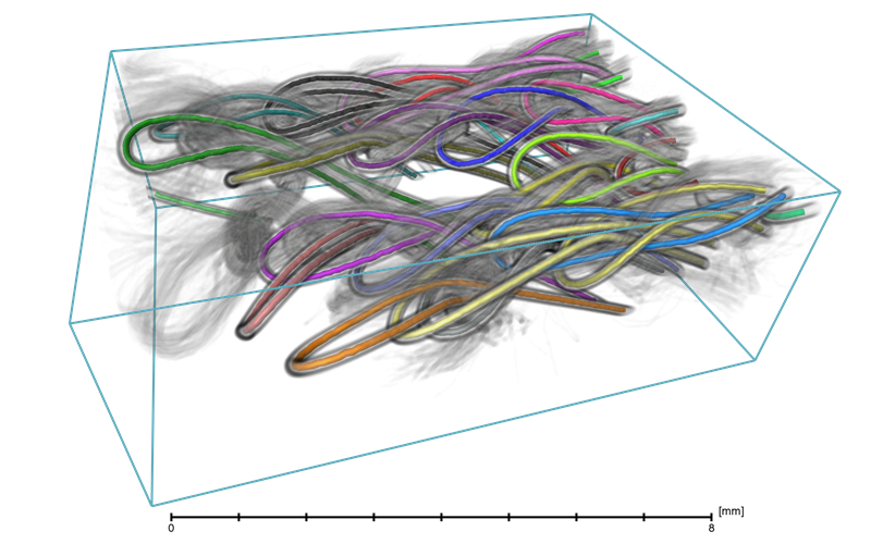 Segmentation and individualization of fibers