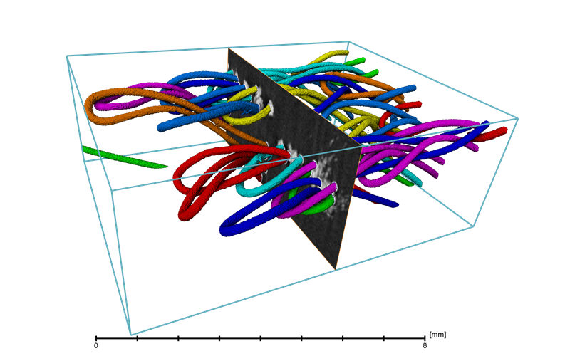 Individualization & X-ray slice of textile fibers