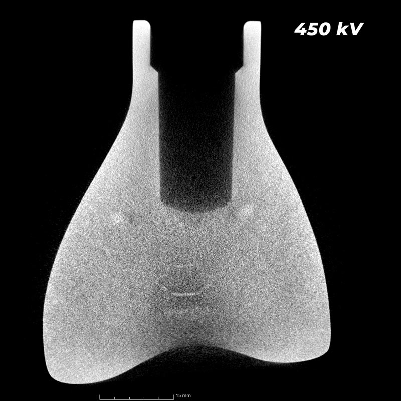 Medical tomographie industrielle haute energie