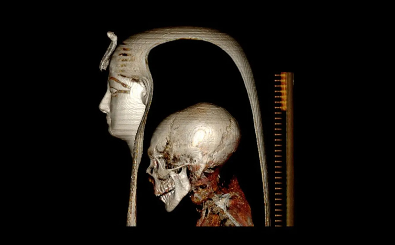 Tomographie par rayons X - Pharaon Amenothep 12