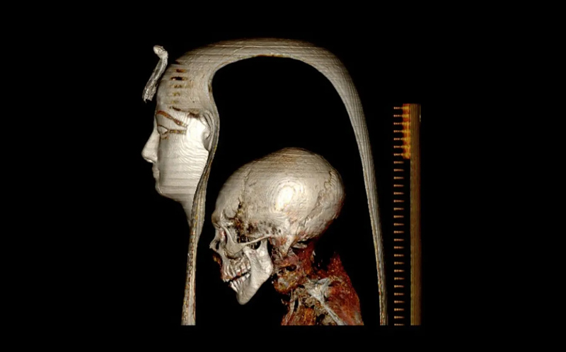 Amenothep tomography 1st