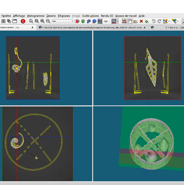 Rendu 3D scan tomographie