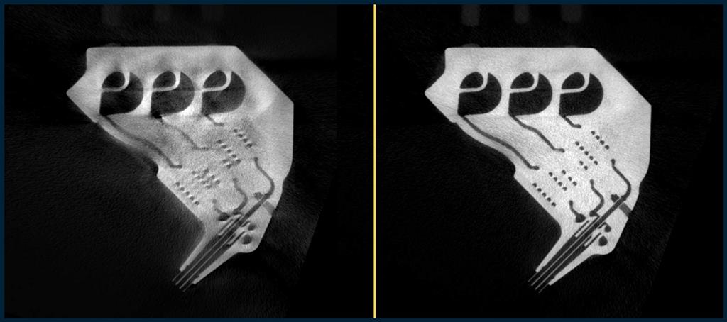 reconstruction avancee HORUS RX Solutions comparaison scans