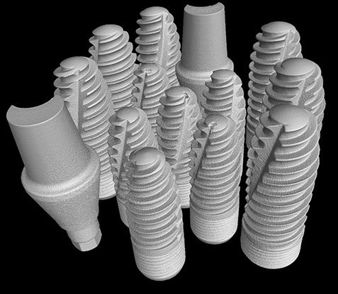implants dentaires vus en tomographie, reconstruction 3D