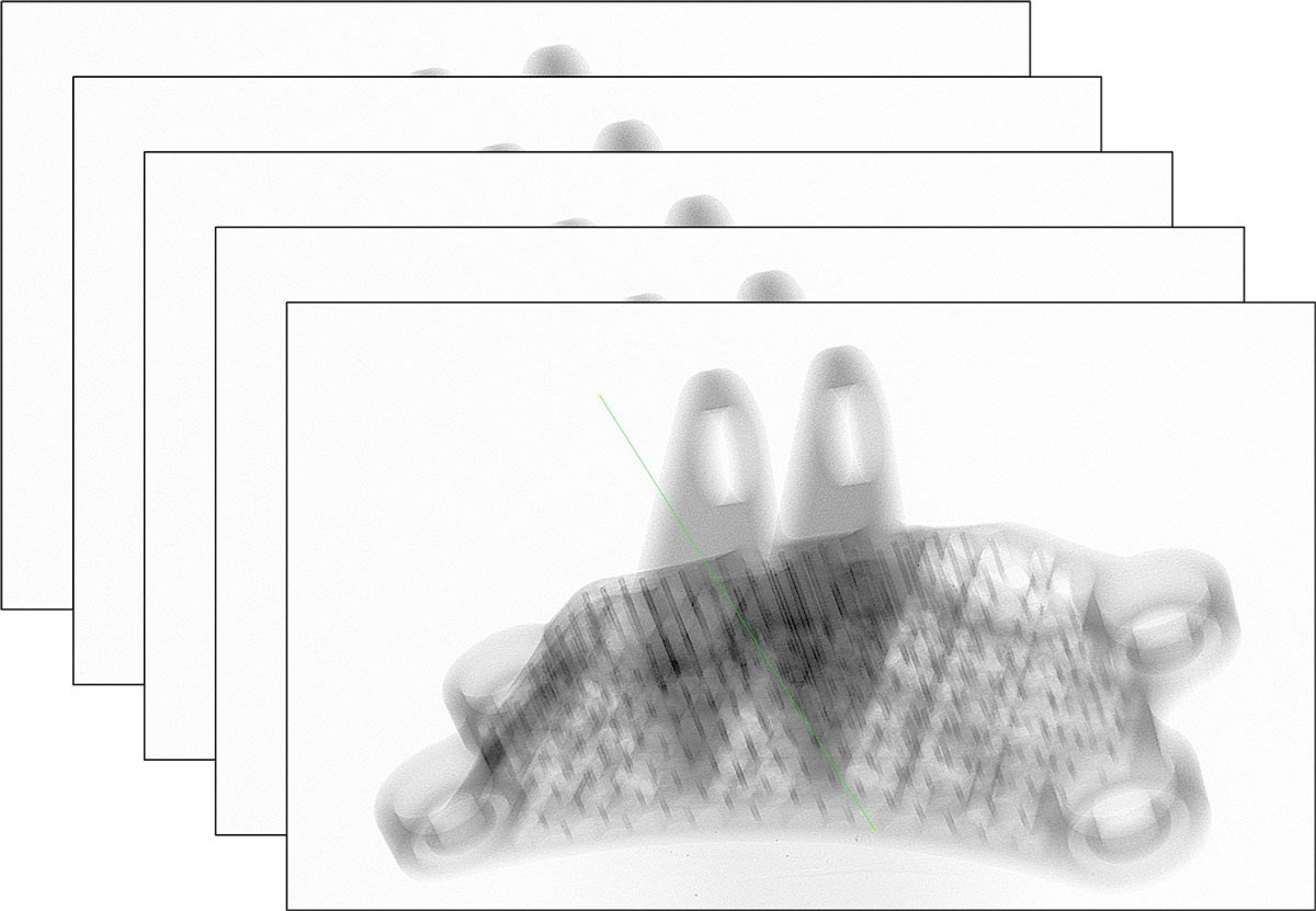X-Act acquisition tomographie