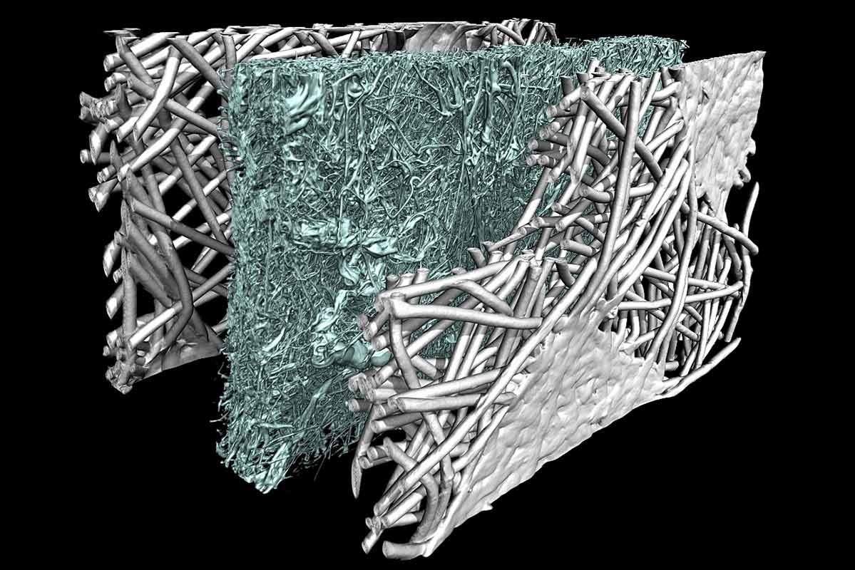 Analyse fibres par microtopographie