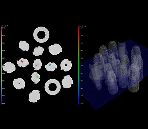 implant_dentaire_analyse_tomographie_RX_Solutions