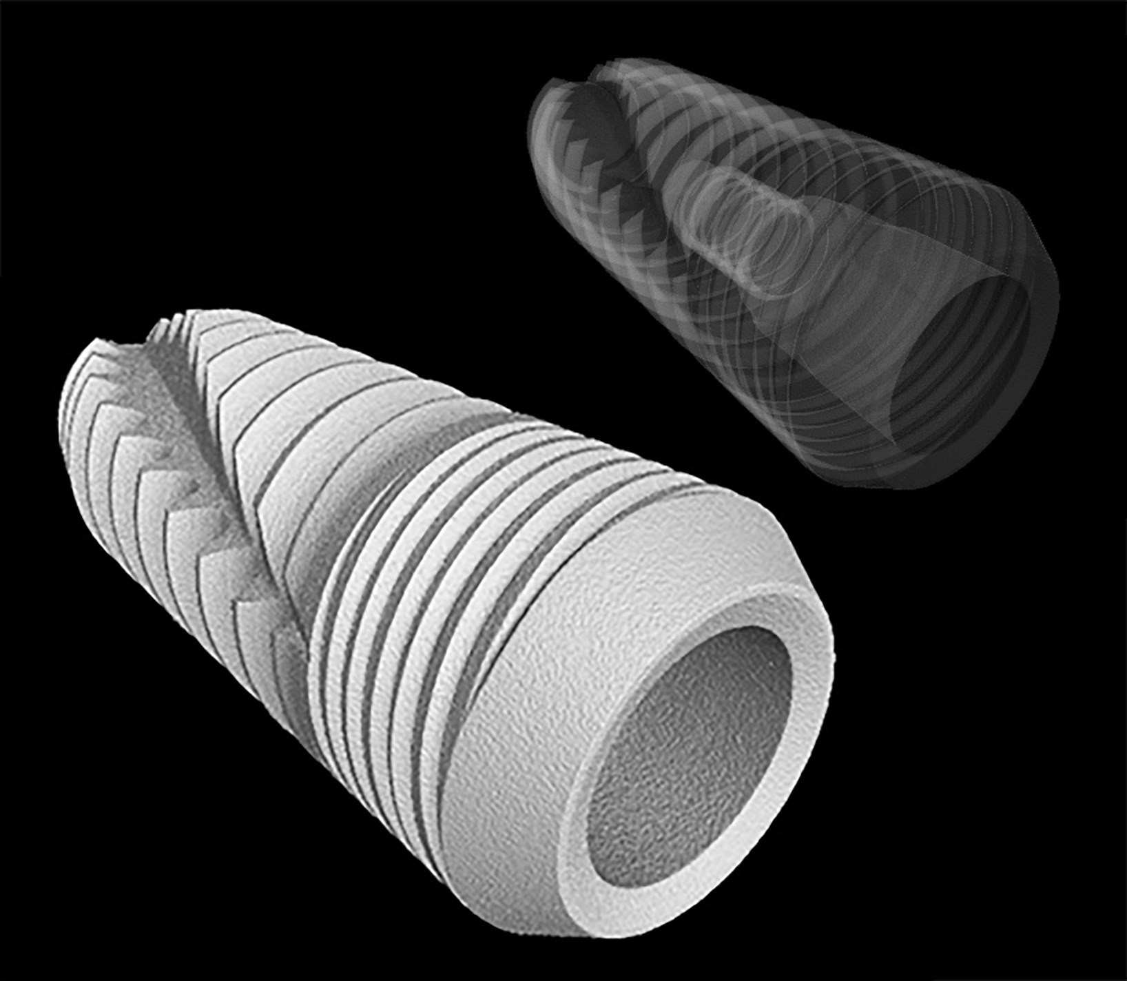 implants_dentaires_RX_Solutions_tomography_Explorer