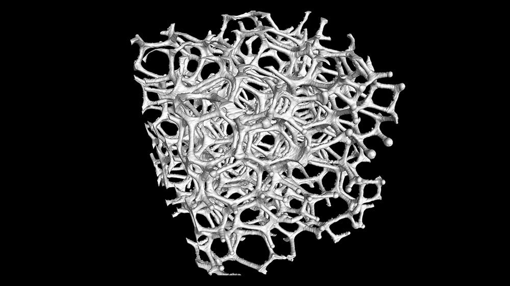 Tomographie nanométrique