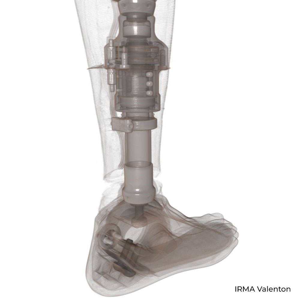 prothèse_jambes_IRMA_Valenton_Tomography_RX_Solutions_microCT