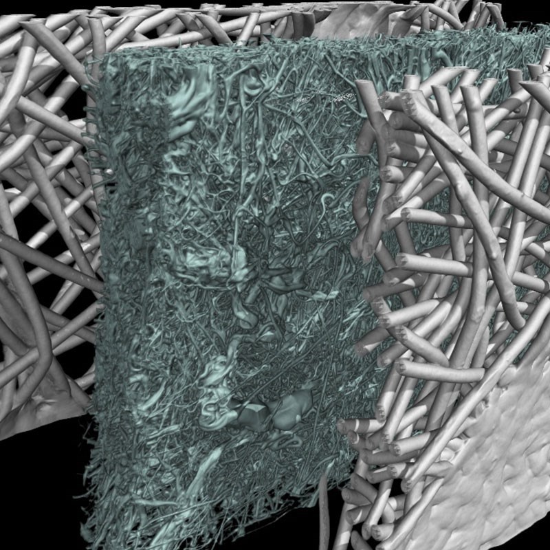 Pour les microstructures, implants poreux et mat&eacute;riaux innovantsImplants en mousse de titane, microstructures poreuses, biomat&eacute;riaux, recherche acad&eacute;mique et caract&eacute;risation avanc&eacute;e, niveau de d&eacute;tail submicronique.&nbsp;D&eacute;couvrir la r&eacute;solution NANO avec nos syst&egrave;mes nano-CT&nbsp;