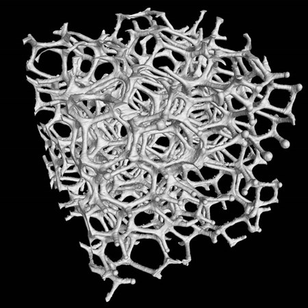 Fabrication additive métallique
