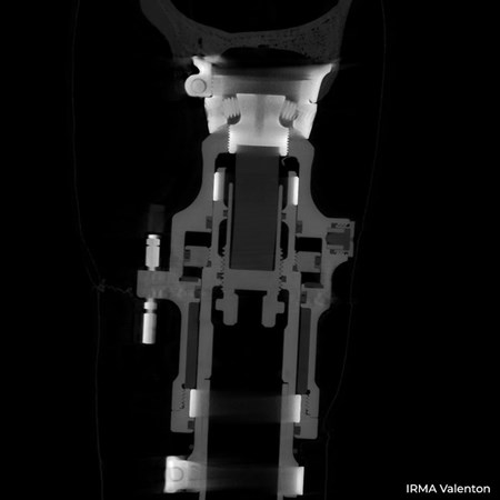 Implants et prothèses