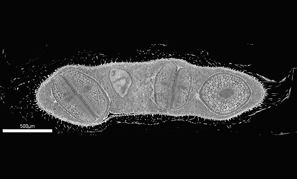 1µm